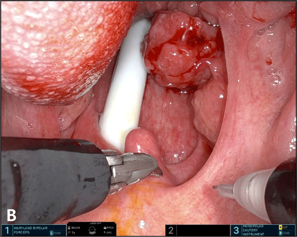 jcohns-35-4-130-g2